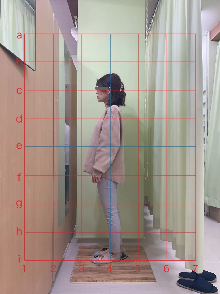 施術の流れ。施術前後の写真 横
