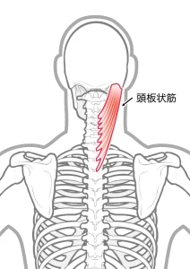 環椎後頭関節と整体。群発頭痛。激痛。頭板状筋