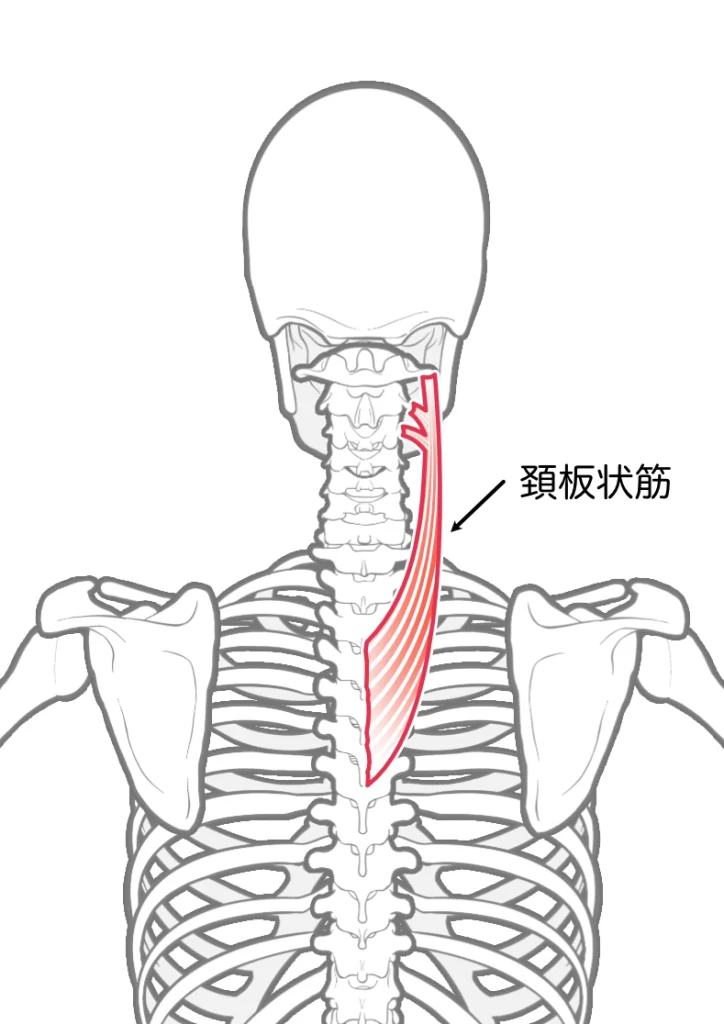 環椎後頭関節と整体。群発頭痛。激痛。椎板状筋