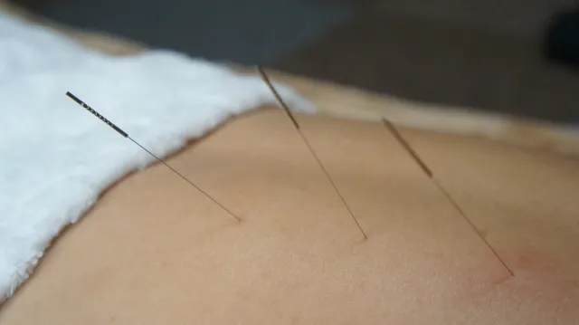 分院から試練の始まり。鍼灸