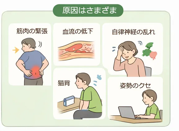 筋肉の緊張・悪い姿勢・自律神経の乱れからくる坐骨神経痛の原因のイラスト